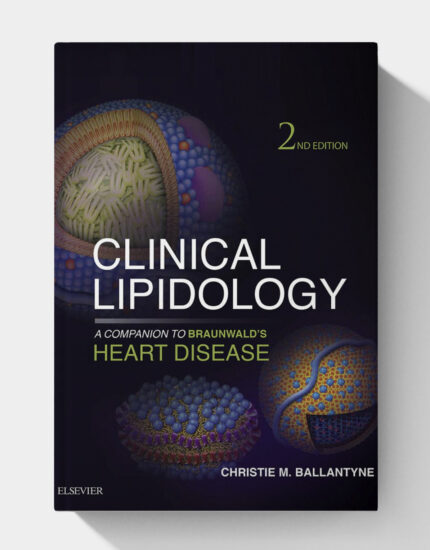 Clinical Lipidology: A Companion to Braunwald's Heart Disease (2nd Edition)
