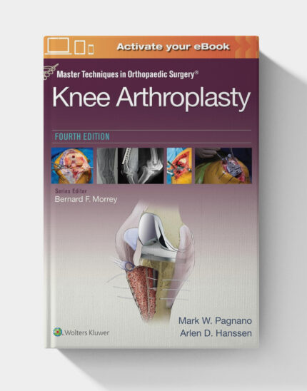 Master Techniques in Orthopedic Surgery: Knee Arthroplasty (4th Edition)