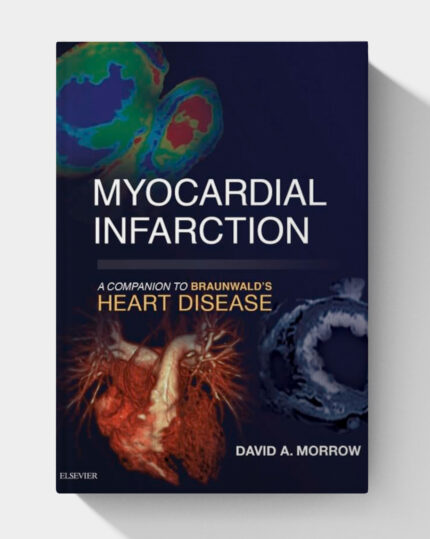 Myocardial infarction : a companion to Braunwald’s heart disease.