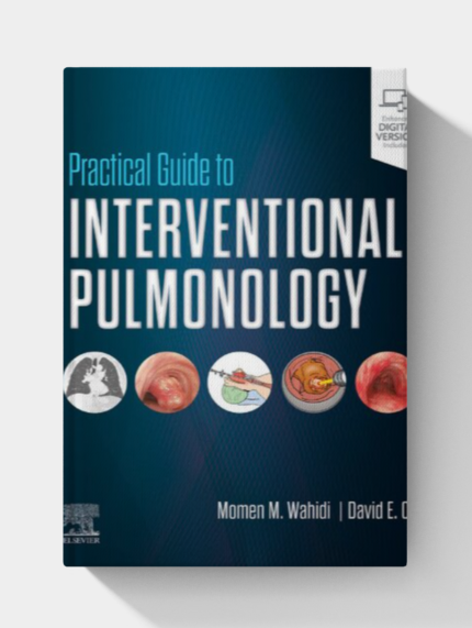 Practical Guide to Interventional Pulmonology (1st Edition)