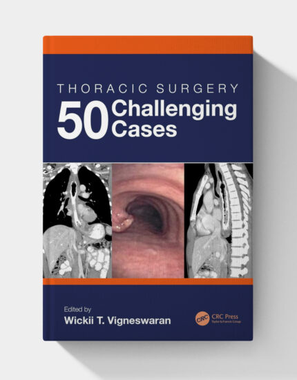 Thoracic Surgery: 50 Challenging cases (1st Edition)