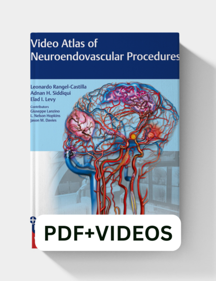 Videos Atlas of Neuroendovascular Procedures (1st Edition)